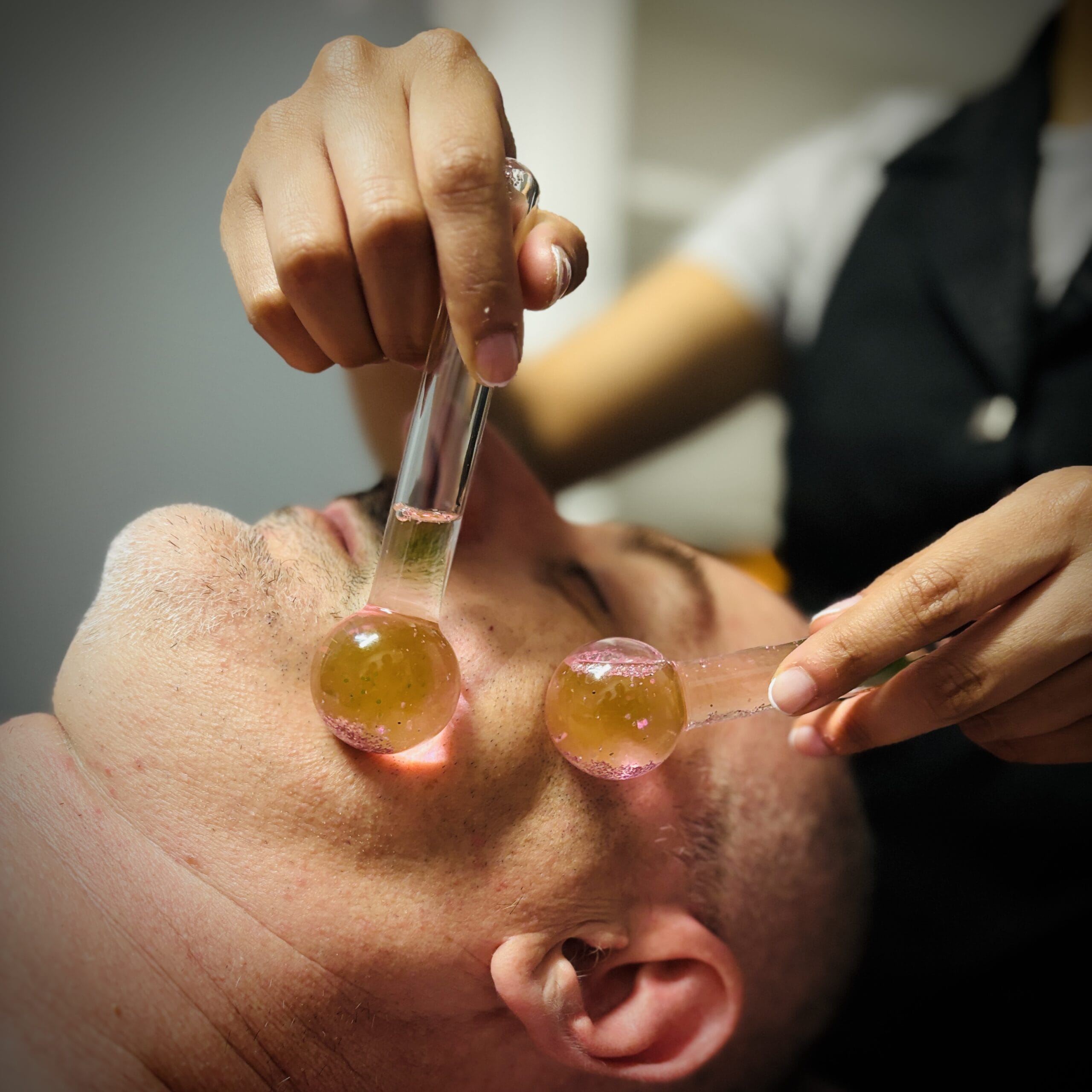 trattamento esfoliante