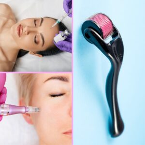 microneedling